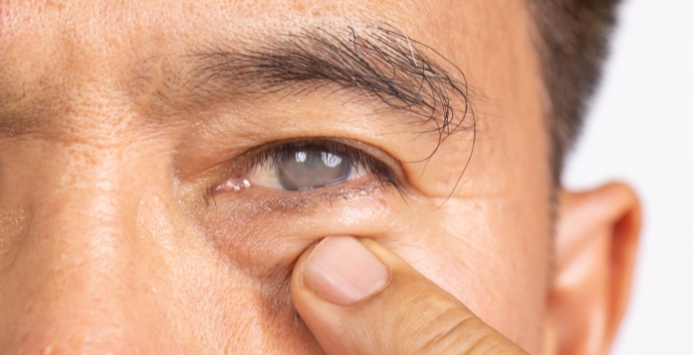 Inteligência artificial permite prever a evolução do glaucoma através de uma fotografia do olho